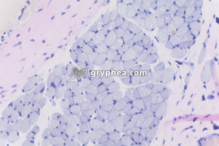 Peau avec glandes sébacées x100 - gryphea.com